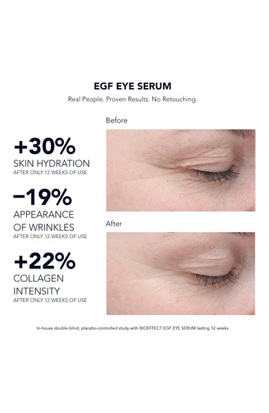 EGF Eye Serum